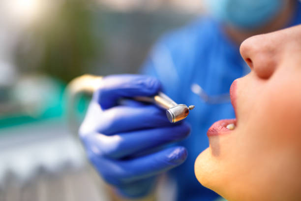 Best Veneers and Lumineers  in Union City, TN